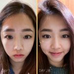 B4andafter